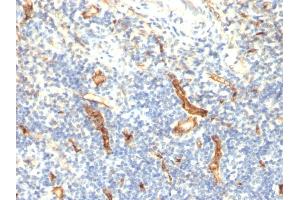 Formalin-fixed, paraffin-embedded human Tonsil stained with CD34 Monoclonal Antibody (HPCA1/1171)