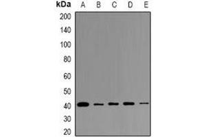 Western blot analysis of LPAAT gamma expression in K562 (A), A549 (B), PC12 (C), mouse testis (D), rat testis (E) whole cell lysates. (AGPAT3 抗体)
