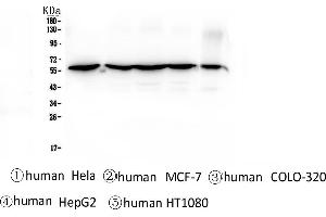 Western blot analysis of CCT3 using anti-CCT3 antibody . (CCT3 抗体  (C-Term))