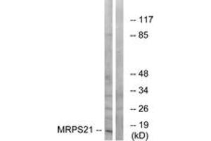 Western Blotting (WB) image for anti-Mitochondrial Ribosomal Protein S21 (MRPS21) (AA 38-87) antibody (ABIN2890407) (MRPS21 抗体  (AA 38-87))