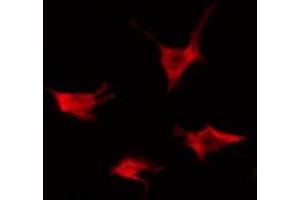 Immunofluorescence (fixed cells) (IF/ICC) image for anti-Activin A Receptor Type II-Like 1 (ACVRL1) (Internal Region) antibody (ABIN6256992)