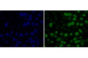 Immunofluorescence analysis of 293T cells using MonoMethyl-Histone H3-K36 Polyclonal Antibody (Histone 3 抗体  (meLys36))