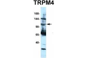 Western Blotting (WB) image for anti-Transient Receptor Potential Cation Channel, Subfamily M, Member 4 (TRPM4) (N-Term) antibody (ABIN2776221)
