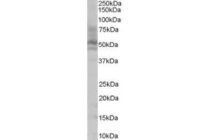 Western Blotting (WB) image for anti-Proline and Serine-Rich Protein 2 (PROSER2) (C-Term) antibody (ABIN2786271) (PROSER2 抗体  (C-Term))