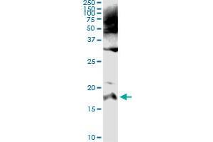 Immunoprecipitation of SPINK1 transfected lysate using mouse monoclonal anti-SPINK1 and Protein A Magnetic Bead (SPINK1 (人) IP-WB Antibody Pair)