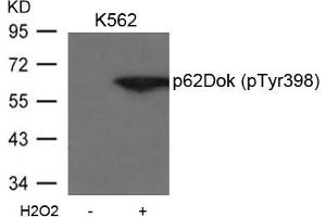 Western blot analysis of extracts from K562 cells untreated or treated with H2O2 using p62Dok(phospho-Tyr398) Antibody.