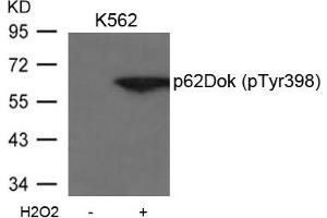 Western blot analysis of extracts from K562 cells untreated or treated with H2O2 using p62Dok(phospho-Tyr398) Antibody. (DOK1 抗体  (pTyr398))