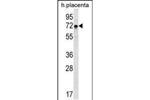 Western blot analysis in human placenta tissue lysates (35ug/lane). (GNE 抗体  (N-Term))