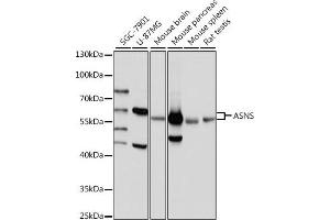 Western blot analysis of extracts of various cell lines, using ASNS antibody (ABIN7265693) at 1:1000 dilution. (Asparagine Synthetase 抗体  (AA 262-561))