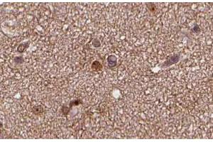 ABIN6266635 at 1/100 staining human brain tissue sections by IHC-P. (SNAP25 抗体  (C-Term))