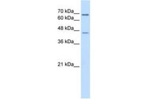 Image no. 2 for anti-Aldehyde Dehydrogenase 3 Family, Member A2 (ALDH3A2) (AA 351-400) antibody (ABIN6736668) (ALDH3A2 抗体  (AA 351-400))