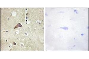 Immunohistochemistry analysis of paraffin-embedded human brain, using NMDAR1 (Phospho-Ser896) Antibody. (GRIN1/NMDAR1 抗体  (pSer897))