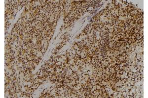 ABIN6274773 at 1/100 staining Rat spleen tissue by IHC-P. (RPL23 抗体  (C-Term))