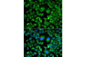 Immunofluorescence analysis of A549 cell using UBE2H antibody. (UBE2H 抗体)