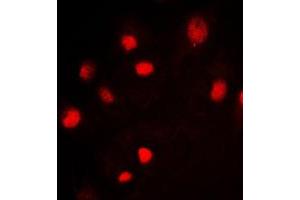 Immunofluorescent analysis of MCM2 staining in Jurkat cells. (MCM2 抗体  (N-Term))