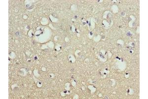 Immunohistochemistry of paraffin-embedded human brain tissue using ABIN7165209 at dilution of 1:100 (CNIH2 抗体  (AA 94-138))
