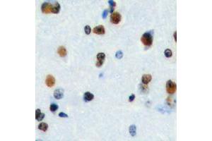 Immunohistochemical analysis of HEN1/2 staining in human brain formalin fixed paraffin embedded tissue section. (HEN1/2 (Center) 抗体)