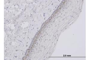 Immunoperoxidase of monoclonal antibody to TFAP4 on formalin-fixed paraffin-embedded human uterine cervix. (TFAP4 抗体  (AA 93-192))