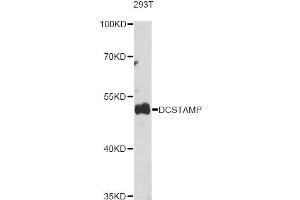 Western blot analysis of extracts of various cell lines, using DCSTAMP antibody (ABIN6293906) at 1:1000 dilution. (Transmembrane 7 Superfamily Member 4 (TM7SF4) 抗体)