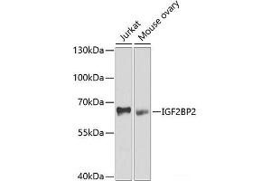 Western blot analysis of extracts of various cell lines using IGF2BP2 Polyclonal Antibody at dilution of 1:1000. (IGF2BP2 抗体)