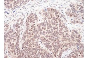 Immunohistochemistry (IHC) image for anti-MYC Associated Factor X (MAX) (AA 110-160) antibody (ABIN7454880)