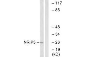 Western blot analysis of extracts from COLO cells, using NRIP3 Antibody. (NRIP3 抗体  (AA 192-241))