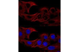 Confocal immunofluorescence analysis of U2OS cells using α-Tubulin antibody (ABIN3020549, ABIN3020550 and ABIN3020551) at dilution of 1:100 (60x lens). (TUBA4A 抗体  (AA 1-180))