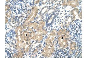 KHK antibody was used for immunohistochemistry at a concentration of 4-8 ug/ml to stain Epithelial cells of renal tubule (arrows) in Human Kidney. (Ketohexokinase 抗体)