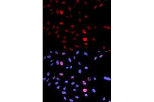 Immunofluorescence (IF) image for anti-Structural Maintenance of Chromosomes 1A (SMC1A) (pSer957) antibody (ABIN3019554) (SMC1A 抗体  (pSer957))