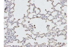Immunohistochemistry (IHC) image for anti-Eukaryotic Translation Initiation Factor 4A2 (EIF4A2) antibody (ABIN1876482) (EIF4A2 抗体)