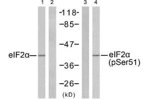 Western blot analysis of extracts from K562 cells untreated or treated with IFN-α (100ng/ml, 20min), using eIF2α (Ab-51) antibody (E021271, Lane 1 and 2) and eIF2α (phospho-Ser51) antibody (E011279, Lane 3 and 4). (EIF2A 抗体  (pSer51))