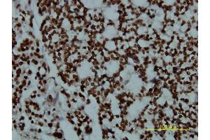 Immunostaining (ISt) image for anti-POU domain, class 2, transcription factor 2 (POU2F2) (AA 1-400) antibody (ABIN562320)