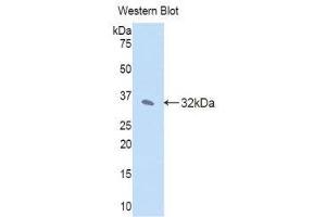 Western Blotting (WB) image for anti-Janus Kinase 2 (JAK2) (AA 120-367) antibody (ABIN1176454) (JAK2 抗体  (AA 120-367))