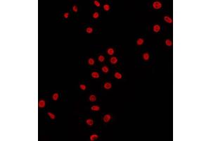 Immunofluorescence (fixed cells) (IF/ICC) image for anti-DNA (Cytosine-5-)-Methyltransferase 3 beta (DNMT3B) (N-Term) antibody (ABIN6261344)