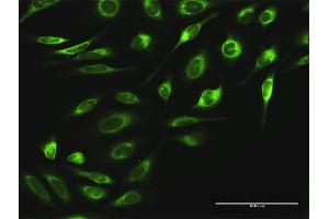 Immunofluorescence of purified MaxPab antibody to RPN2 on HeLa cell. (Ribophorin II 抗体  (AA 1-631))