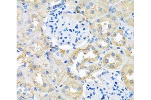 Immunohistochemistry of paraffin-embedded Rat kidney using COTL1 Polyclonal Antibody at dilution of 1:100 (40x lens). (COTL1 抗体)