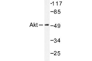 Image no. 1 for anti-V-Akt Murine Thymoma Viral Oncogene Homolog 1 (AKT1) antibody (ABIN265304) (AKT1 抗体)