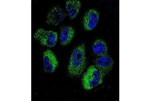 Confocal immunofluorescent analysis of IL13 Antibody (C-term) (ABIN657659 and ABIN2846653) with NCI- cell line followed by Alexa Fluor 488-conjugated goat anti-rabbit lgG (green).