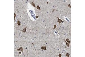 Immunohistochemical staining of human hippocampus shows strong cytoplasmic positivity in neuronal cells. (YARS 抗体)