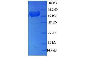 SDS-PAGE (SDS) image for Mannose Phosphate Isomerase (MPI) (AA 1-391) protein (His tag) (ABIN7585136)