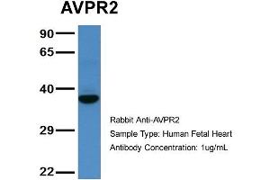 Host: Rabbit  Target Name: AVPR2  Sample Tissue: Human Fetal Heart  Antibody Dilution: 1. (AVPR2 抗体  (C-Term))