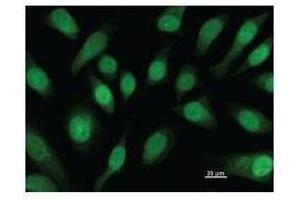 Immunostaining analysis in HeLa cells. (CBFB 抗体)
