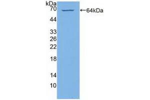 Western blot analysis of recombinant Human PI4Ka. (PI4KA 抗体  (AA 1-300))
