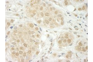 anti-THO Complex 5 (THOC5) (AA 25-75) antibody