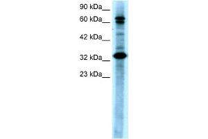 WB Suggested Anti-MAP3K7IP2 Antibody Titration:  0. (TAB2 抗体  (N-Term))