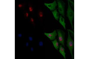 ABIN6266054 and ABIN6276599 staining  cells by IF/ICC. (WT1 抗体  (N-Term))