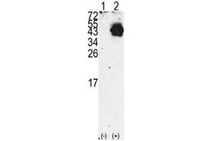 Western blot analysis of PDX1 antibody and 293 cell lysate either nontransfected (Lane 1) or transiently transfected with the PDX1 gene (2). (PDX1 抗体  (AA 40-69))