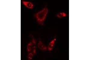 ABIN6275852 staining HuvEc cells by IF/ICC. (PHKG1 抗体  (Internal Region))