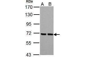 WB Image PCK2 antibody [C1C2], Internal detects PCK2 protein by Western blot analysis. (PEPCK 抗体)