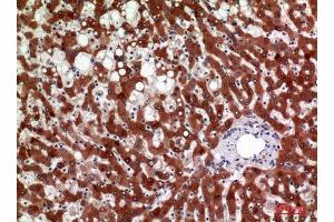 Immunohistochemistry (IHC) analysis of paraffin-embedded Human Liver, antibody was diluted at 1:100. (HSD11B1 抗体  (Internal Region))